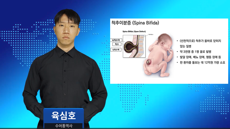 연세대팀, 세계 최초 선천성 척추이분증 원인 규명